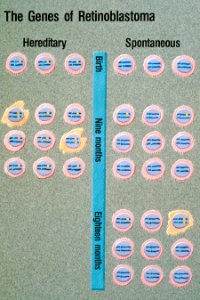 Retinoblastoma illustration