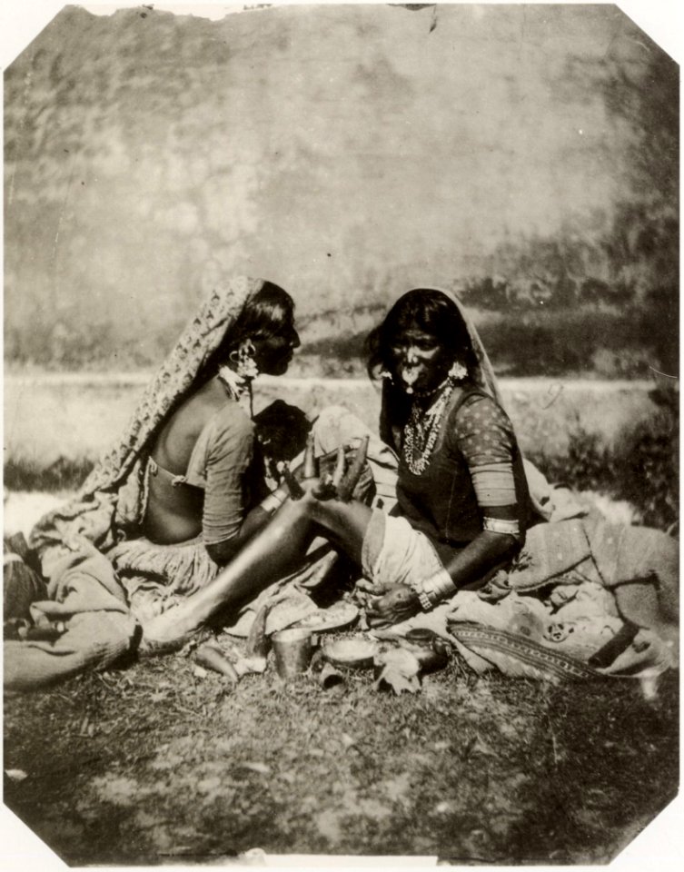 Schlagintweit, Robert - Eine brahmanische Naturheilpraktikerin beim Schröpfen, Bengalen (Zeno Fotografie)