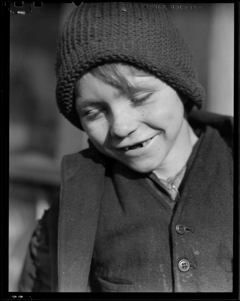 Scott's Run, West Virginia. Miner's child - Father unemployable. - NARA - 518416
