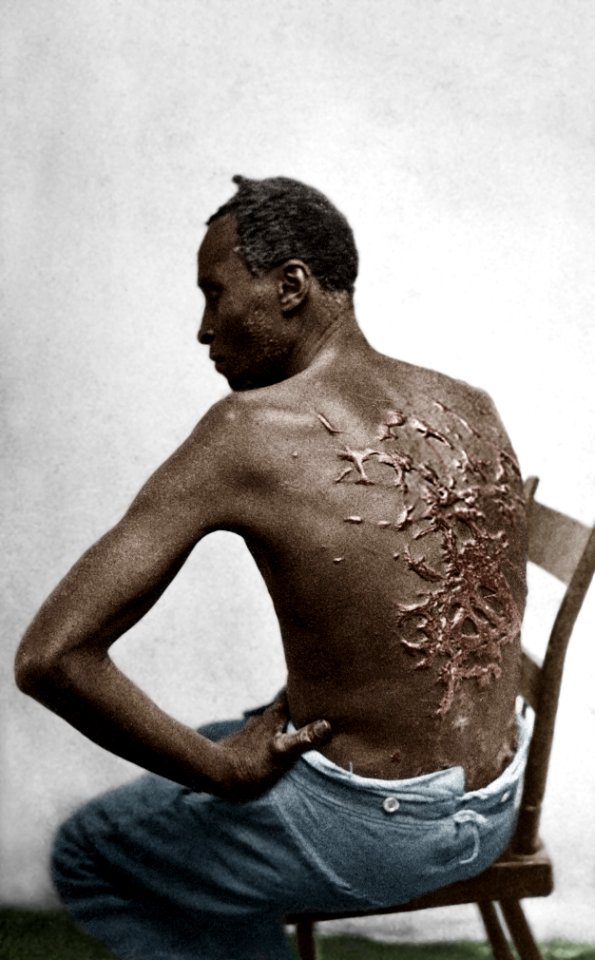 Scourged back by McPherson & Oliver, 1863, colourised