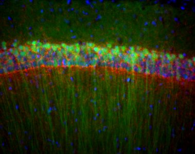 CA1 hippocampus