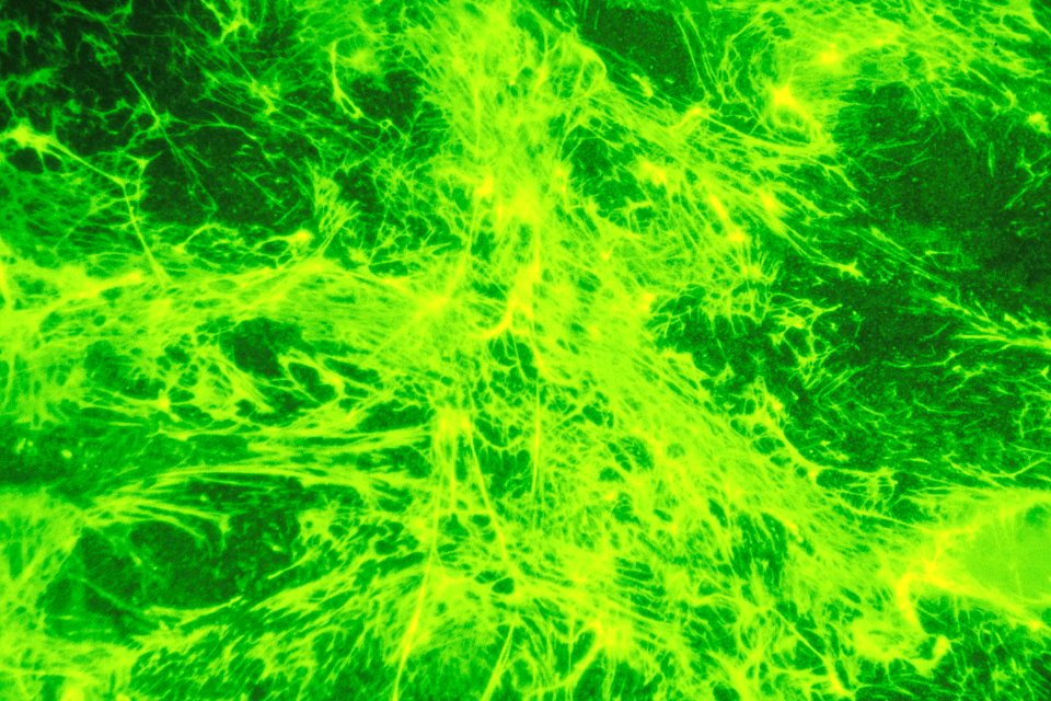 Fibronectin (1)
