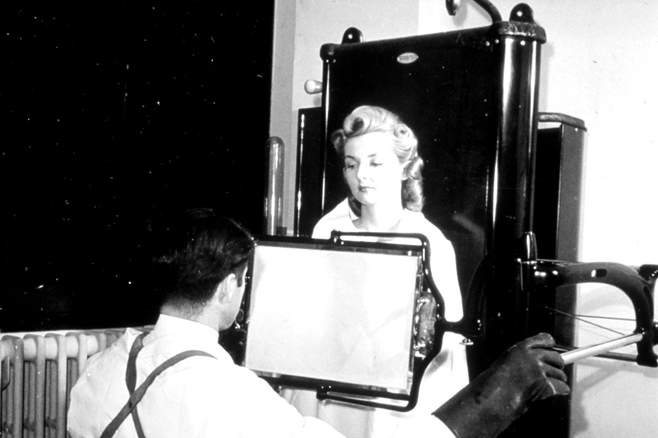 Historical X-ray nci-vol-1893-300