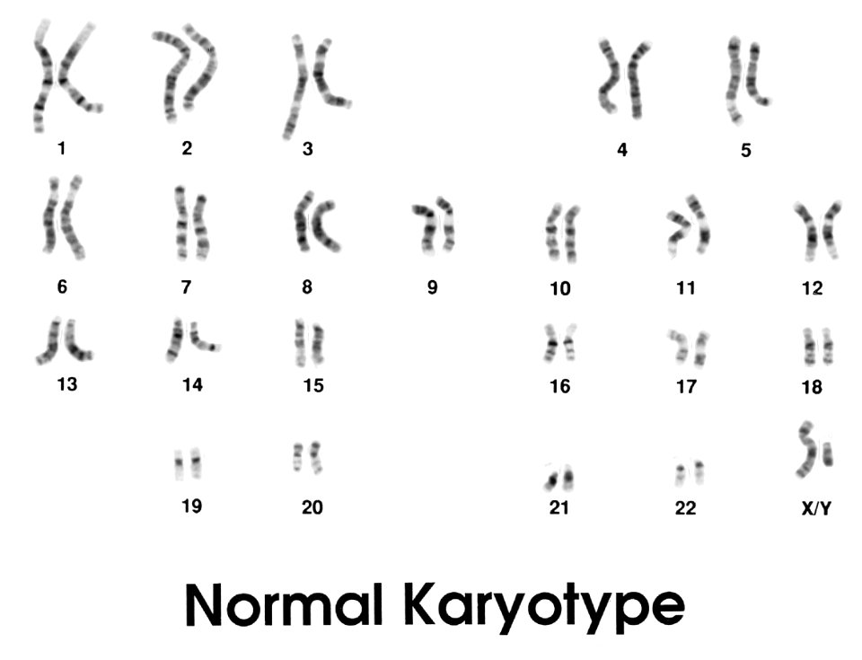 Karyotype (normal)