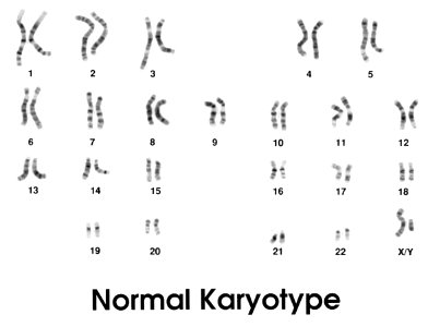 Karyotype (normal) photo