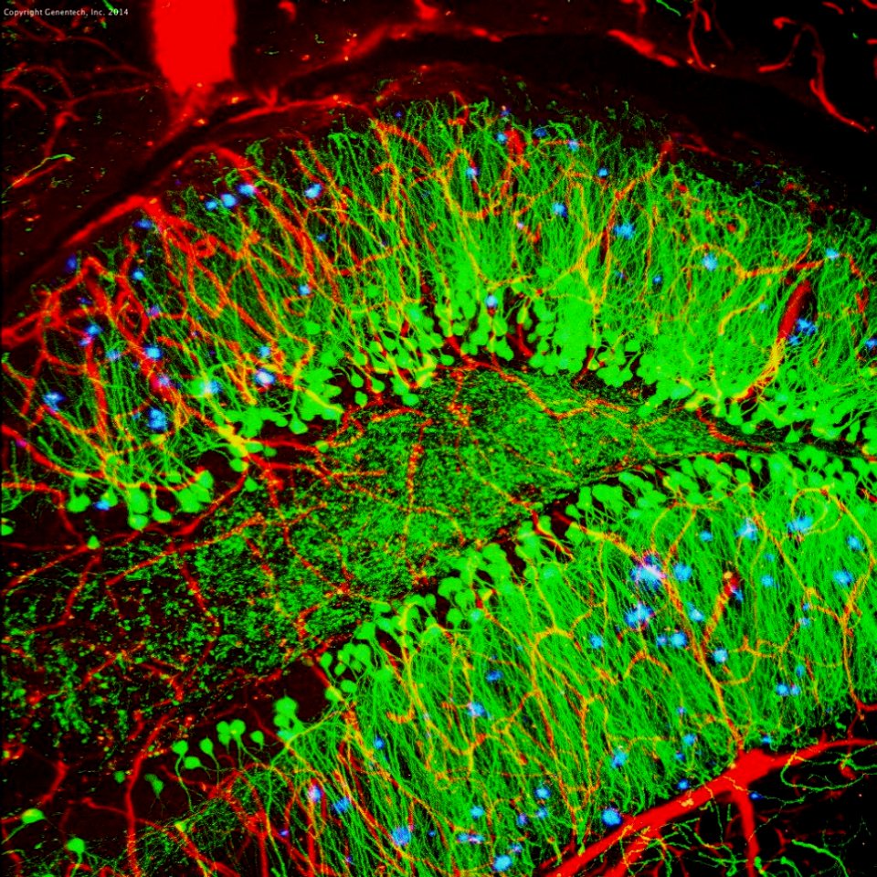 Mouse Brain (48908239833)