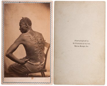 Scourged back by McPherson & Oliver, 1863