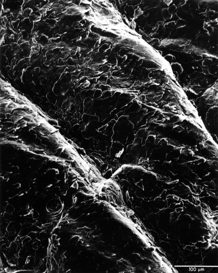 Skin surface (human)