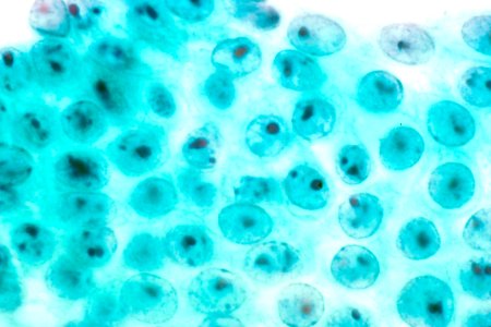 Stomach cells that are non-malignant