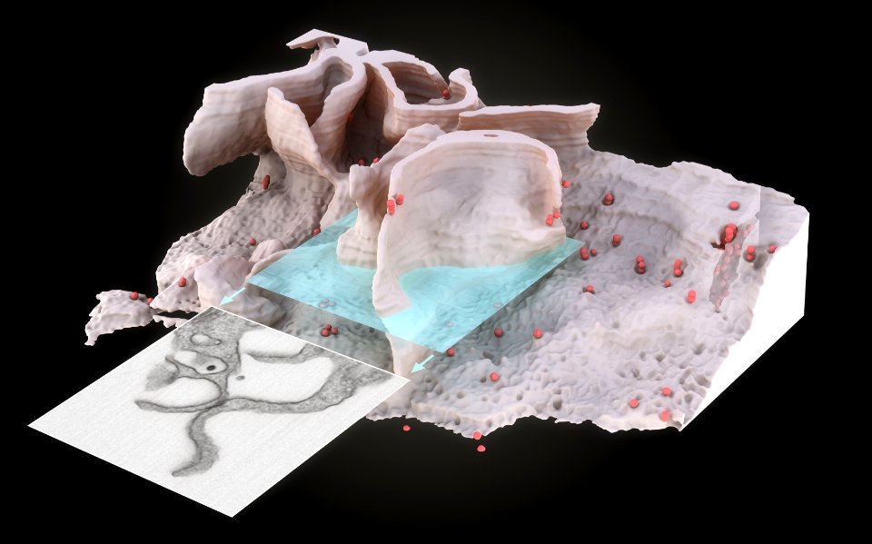 Surface of HIV infected microphage