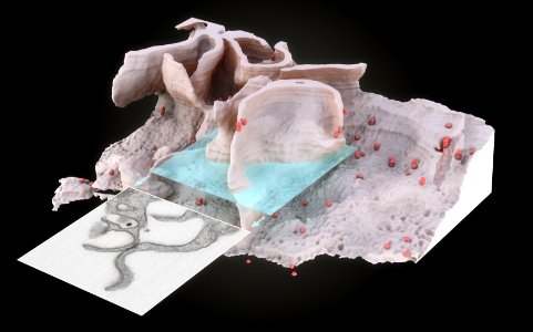 Surface of HIV infected microphage