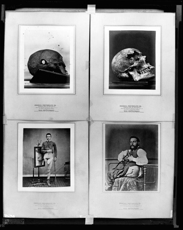 Surgical photograph ... prepared under the supervision of ... War Department, Surgeon General's Office, Army Medical Museum LCCN2005696470