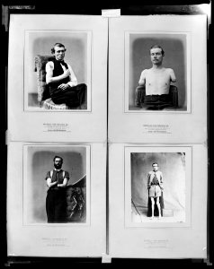 Surgical photograph ... prepared under the supervision of ... War Department, Surgeon General's Office, Army Medical Museum LCCN2005696469