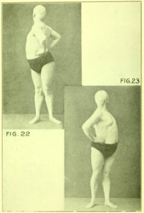 Tensing Exercises Fig22