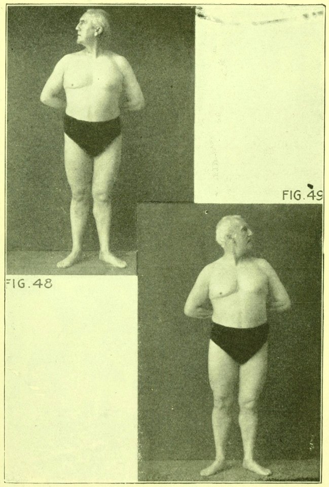 Tensing Exercises Fig48