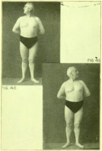Tensing Exercises Fig48