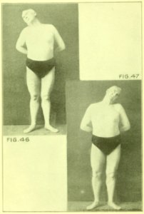 Tensing Exercises Fig46