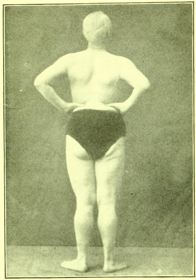 Tensing Exercises Fig06
