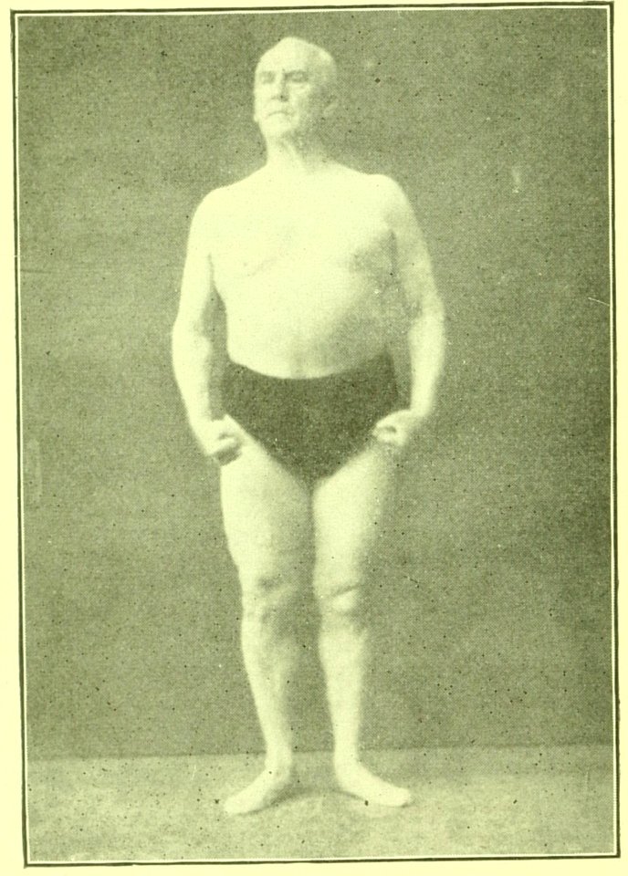 Tensing Exercises Fig17