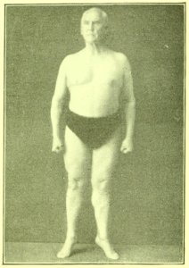 Tensing Exercises Fig32