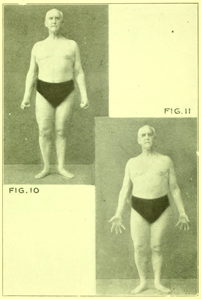 Tensing Exercises Fig10