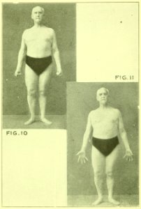 Tensing Exercises Fig10