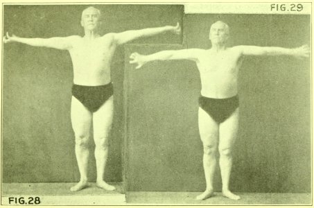 Tensing Exercises Fig28