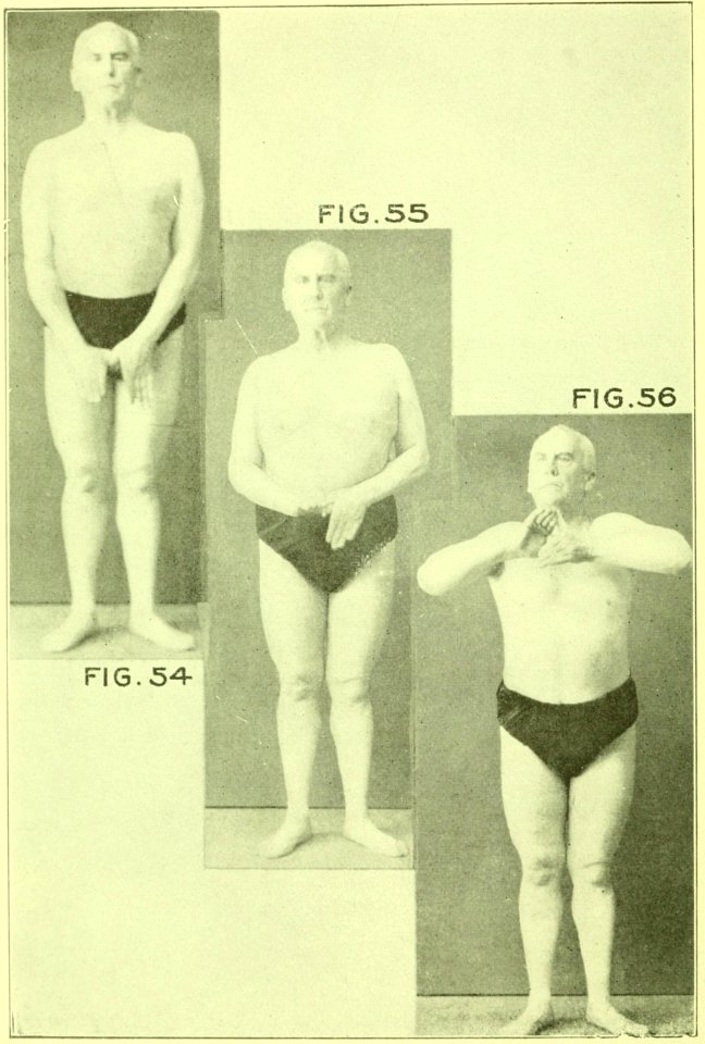 Tensing Exercises Fig54