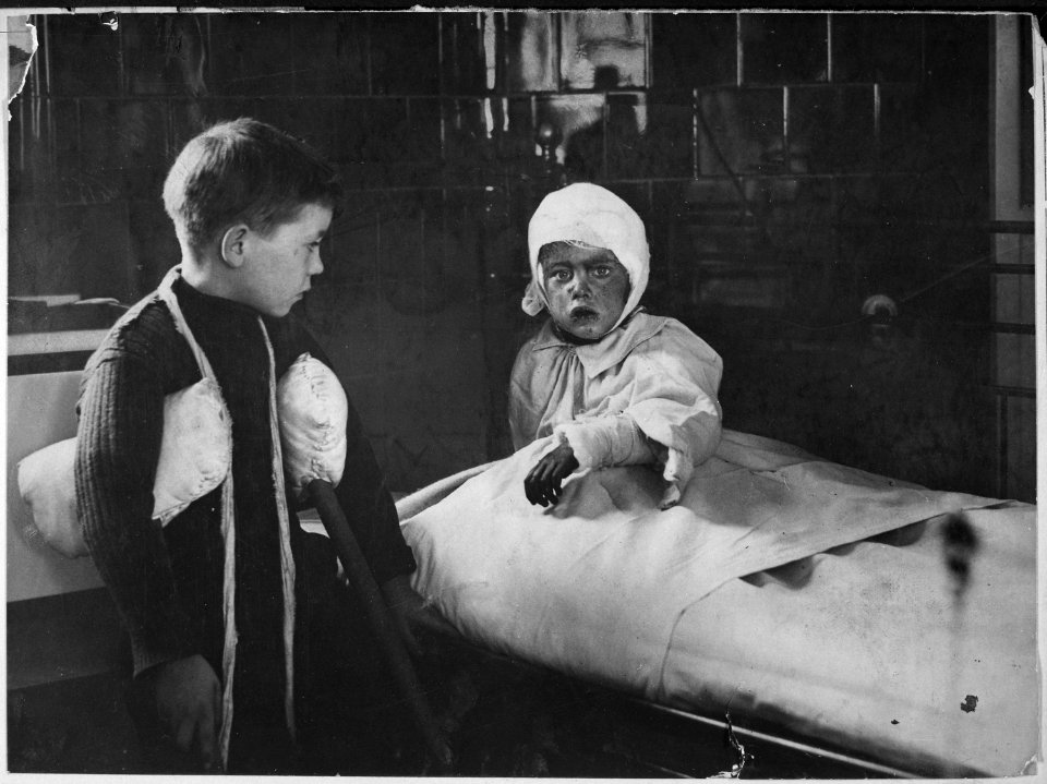 The Great Air Raid on London. Some of the wounded schoolchildren in a hospital., ca. 1915 - NARA - 533648