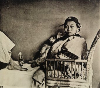 Thomson, John - Der entblößte »Lilienfuß« (Zeno Fotografie)