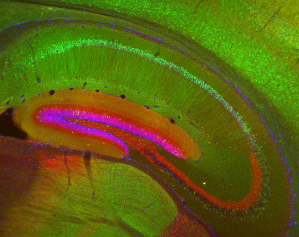Transgenic mouse hippocamus