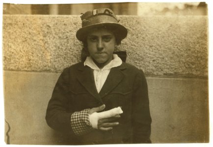 Union Hospital case - Estelle Poiriere, 137 Robeson St., 15 years old. Doffer at Granite No. 1 mill. Laceration of index and middle finger of right hand. Caught in card machine. Injured Dec. LOC cph.3b17935