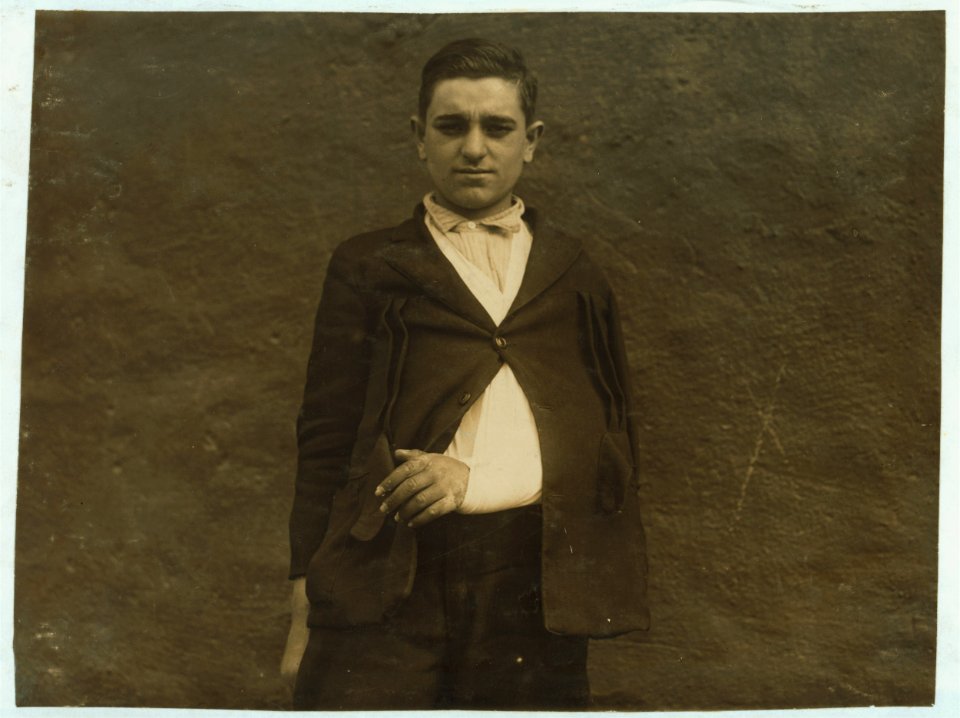 Union Hospital case - Manuel Costa Maiata, 301 Ferry St. Sweeper in Fall River Iron Works five weeks - 17 years old. Broke wrist while sweeping. Slipped on a banana skin. LOC nclc.05072