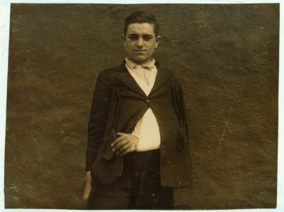 Union Hospital case - Manuel Costa Maiata, 301 Ferry St. Sweeper in Fall River Iron Works five weeks - 17 years old. Broke wrist while sweeping. Slipped on a banana skin. LOC nclc.05072
