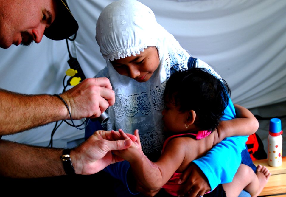 US Navy 050212-N-0357S-071 Cmdr. Kurt Hummeldorf of the U.S. Navy Dental Corps, assesses burns on a young Indonesian child at an International Committee of the Red Cross hospital in Banda Aceh on the island of Sumatra, Indonesi