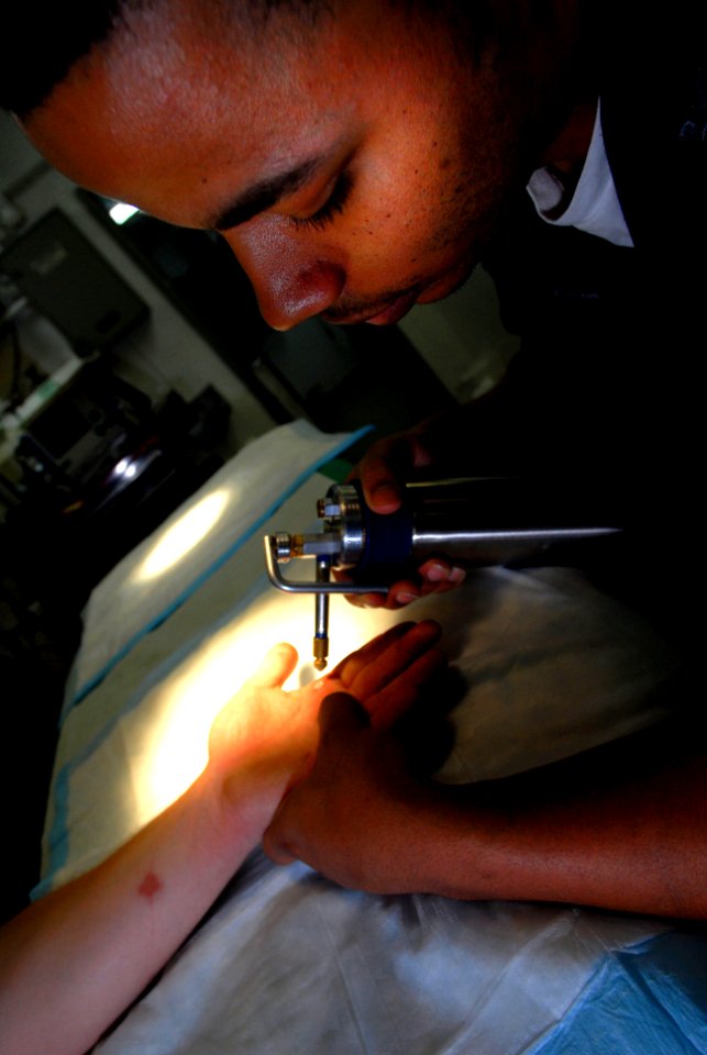 US Navy 070411-N-2659P-031 Hospital Corpsman 3rd Class Kirk Glenn treats a blister on a Sailor's hand in the medical ward aboard the Nimitz-class aircraft carrier USS John C. Stennis (CVN 74)
