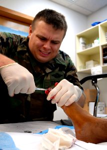 US Navy 080109-N-8547M-031 Hospital Corpsman 2nd Class Jason M. Delonais, assigned to Naval Mobile Construction Battalion (NMCB) 5, removes an ingrown toenail from a patient's foot in the Camp Shields Medical Clinic