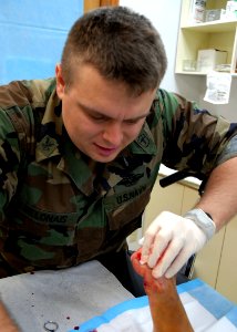 US Navy 080109-N-8547M-047 Hospital Corpsman 2nd Class Jason M. Delonais, assigned to Naval Mobile Construction Battalion (NMCB) 5, removes an ingrown toenail from a patient's foot in the Camp Shields Medical Clinic