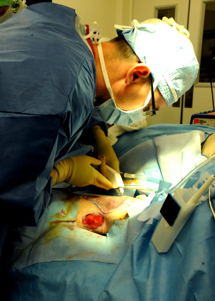 US Navy 110420-N-UB993-105 Capt. Craig Salt, a plastic surgeon assigned to Naval Medical Center San Diego, performs a skin graft as part of the Pro