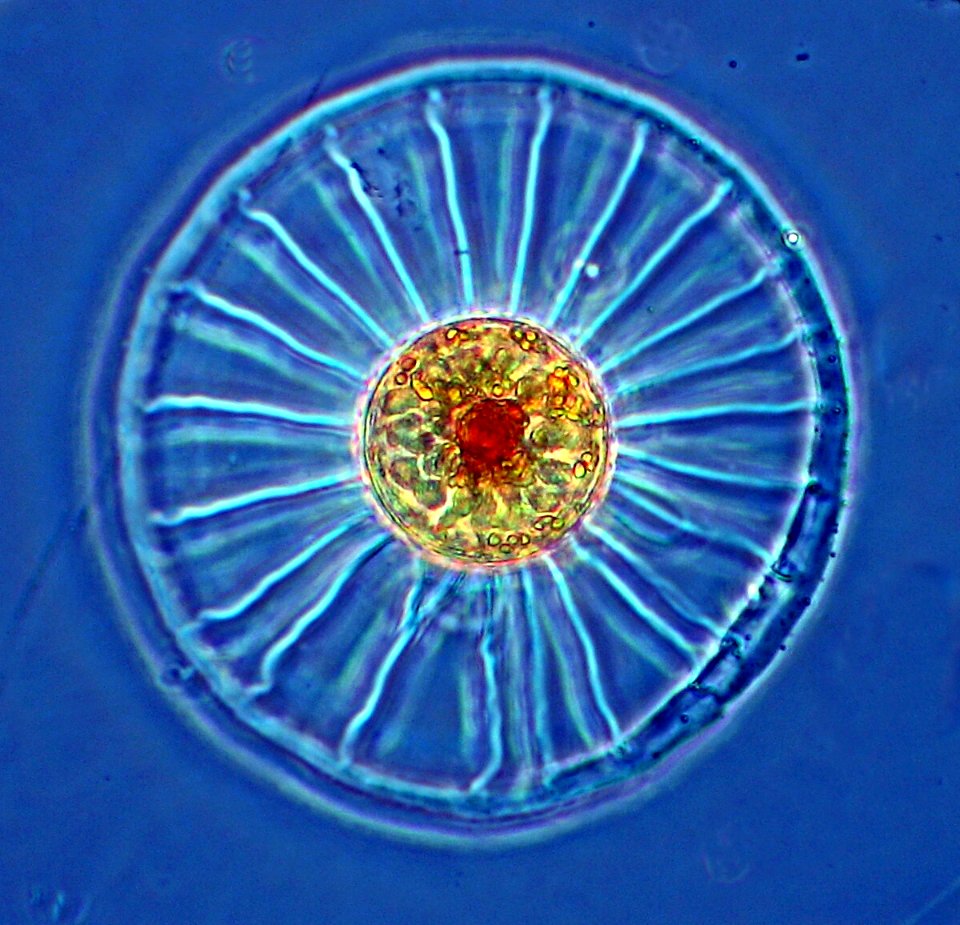 Wagon wheel diatom