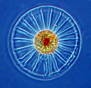 Wagon wheel diatom