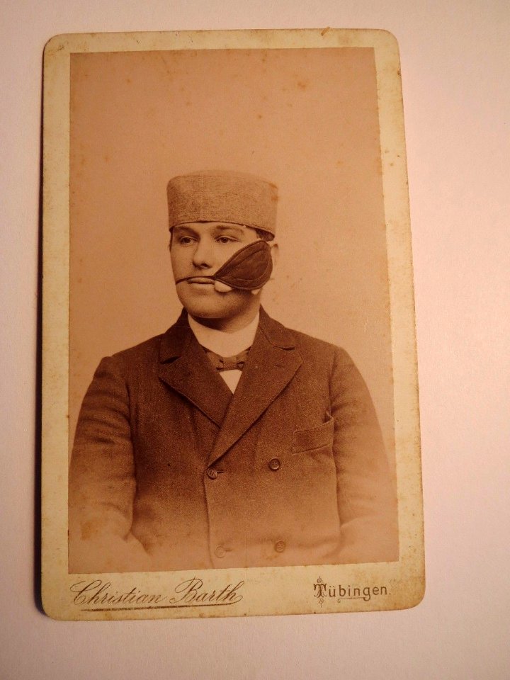Student Hodrus mit Schmissleder nach Mensur (Tübingen - 1896)