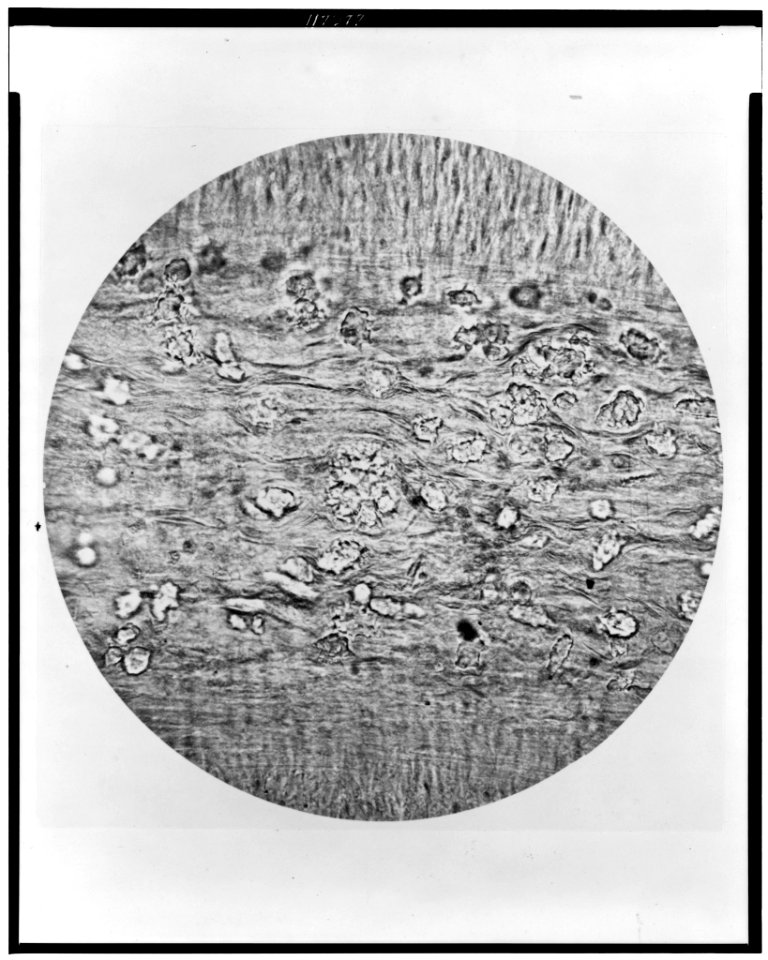 White blood corpuscles, exhibiting amoeboid movements in the external coat of a small vein - from the inflamed stomach of a mare LCCN96522298