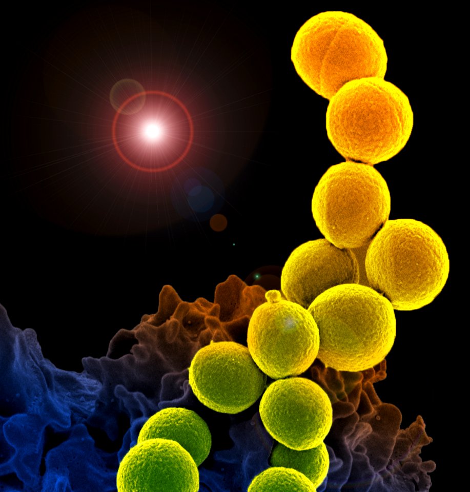 White blood cell with MRSA
