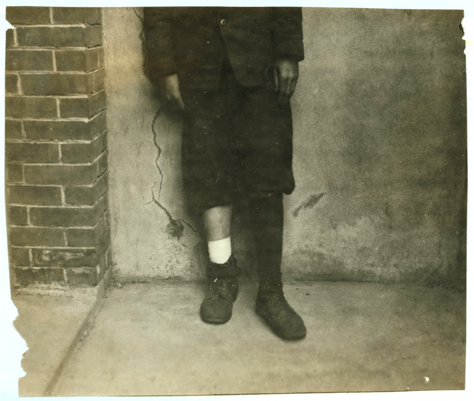 Wilfred Levoie - 15 years - 120 Diman St. - Weaver, American Linen Co. Cut leg June 20, 1916. (See Mr. Wagner's schedule.) Was pushing and pulling basket along floor; basket caught a loose LOC nclc.05076