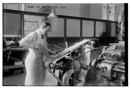 Work on artificial leg LCCN2014708159