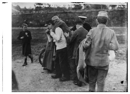 Wounded French soldier LCCN2014700102