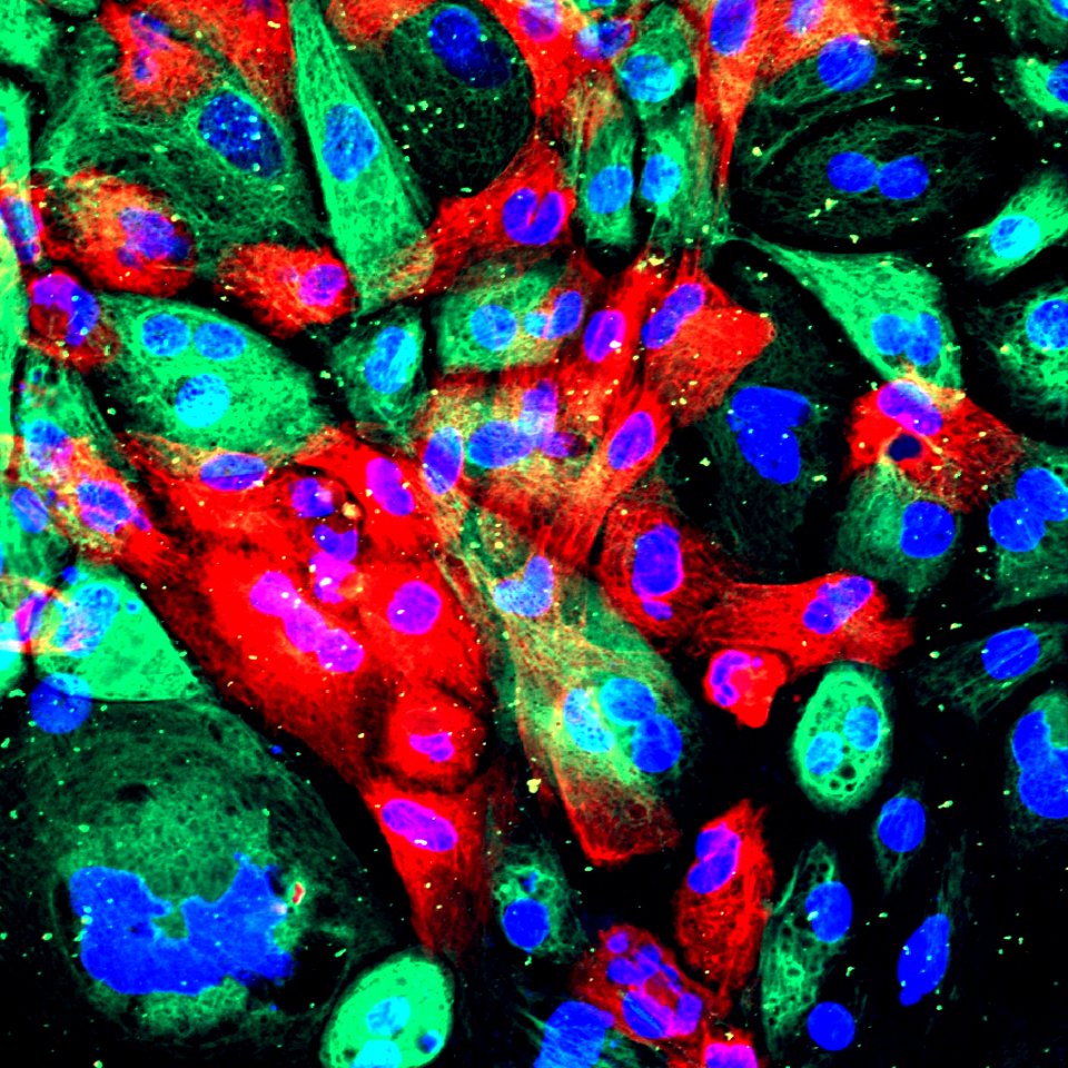 Xenograft Model to Study Prostate Cancer
