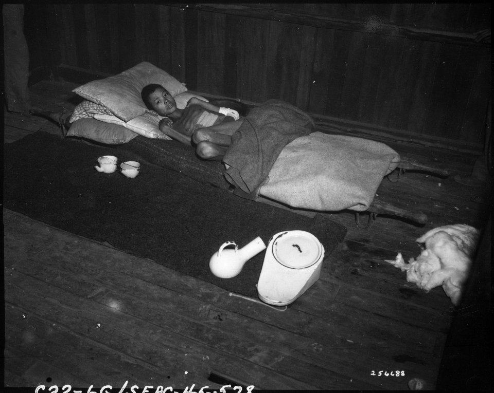 A 12-year old Burmese boy beaten by the Japanese with shovels and rifle butts, suffers from bayonet wounds. He was... - NARA - 531338
