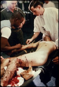 South Vietnam....Marine Corporal J.A. Holland, who sustained heavy shrapnel wounds in his legs, is given treatment in... - NARA - 532501